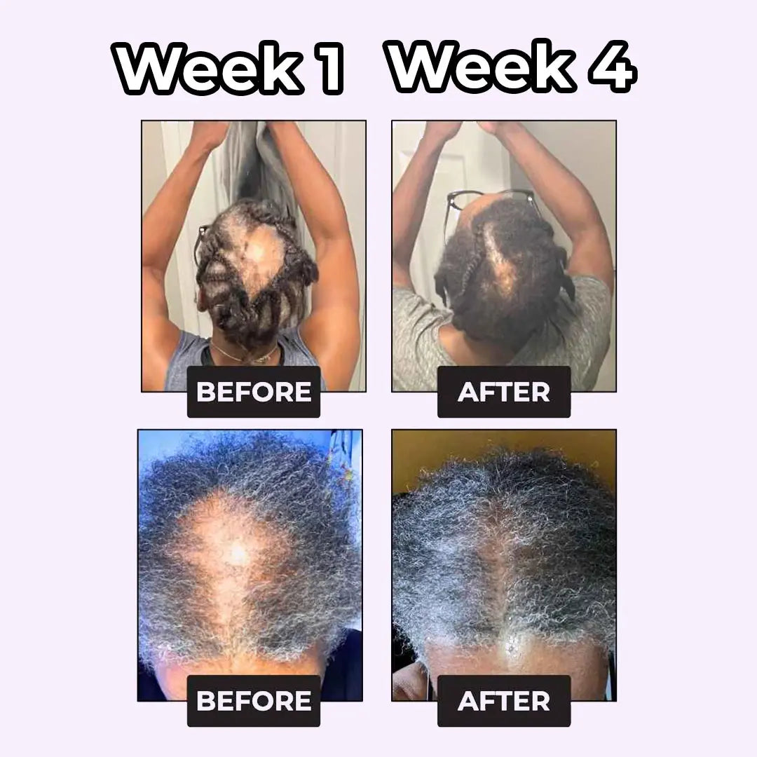 GleamX Rosemary & Rice Water Spray