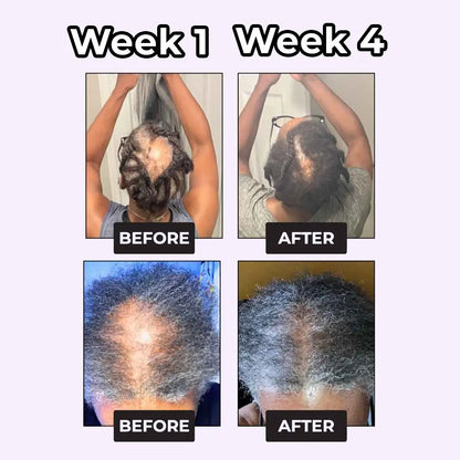 Rosemary & Rice Water Spray - BOGO1